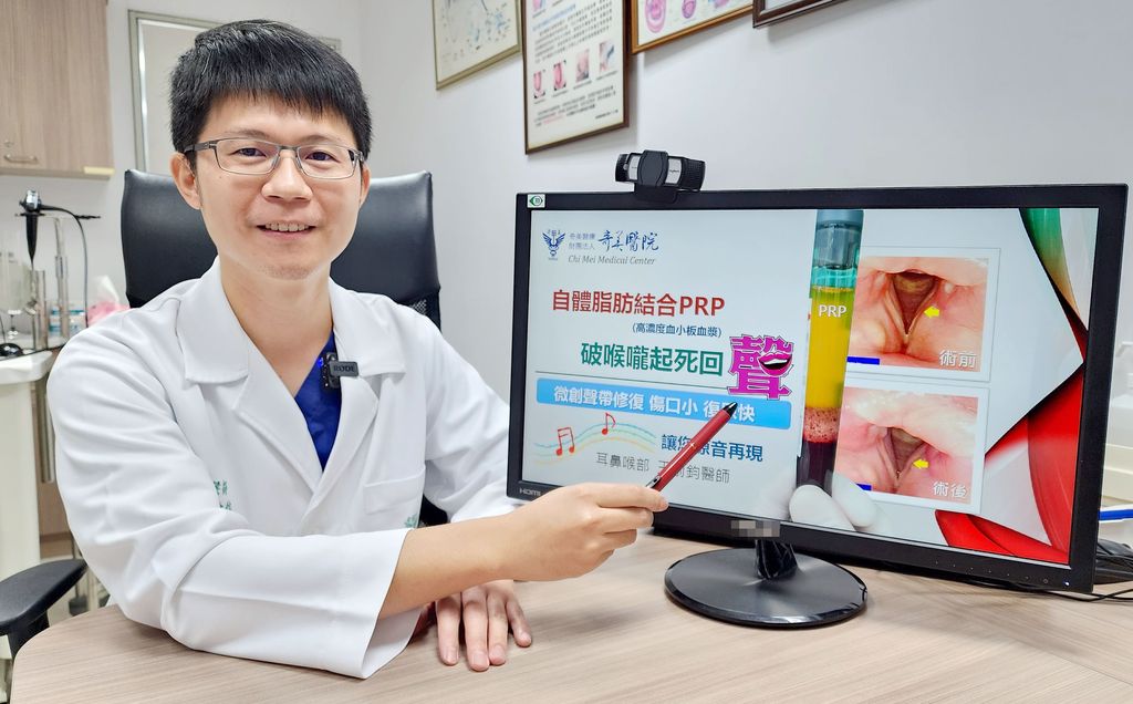 自體脂肪結合PRP,破喉嚨起死回「聲」 自體脂肪結合PRP,破喉嚨起死回「聲」