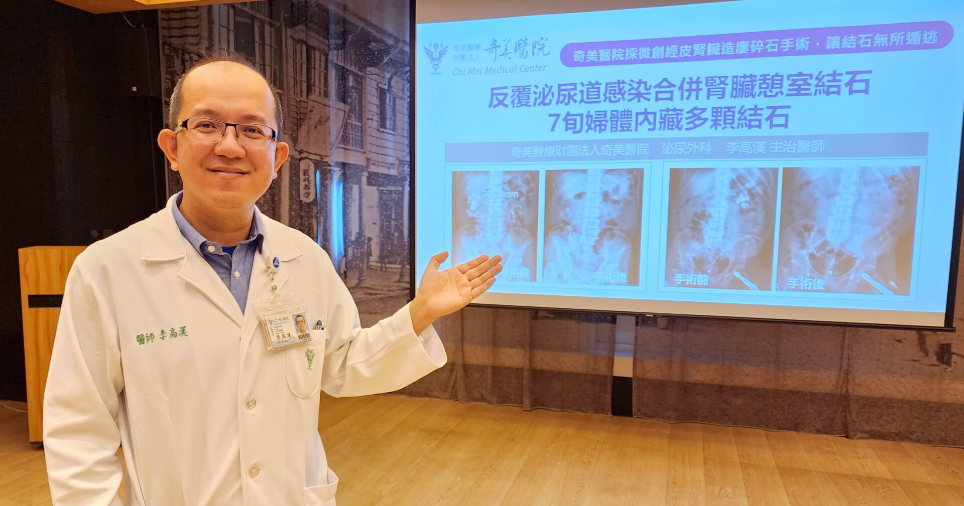 7旬婦體內藏多顆結石 微創經皮腎臟造廔碎石手術搞定 7旬婦體內藏多顆結石 微創經皮腎臟造廔碎石手術搞定