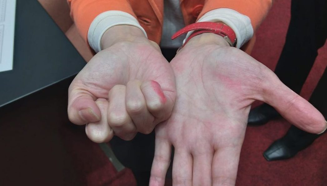 陳昭姿爆發！沾印泥廢票被酸「投不下去」黃珊珊　嗆柯建銘：多數判定是有效票