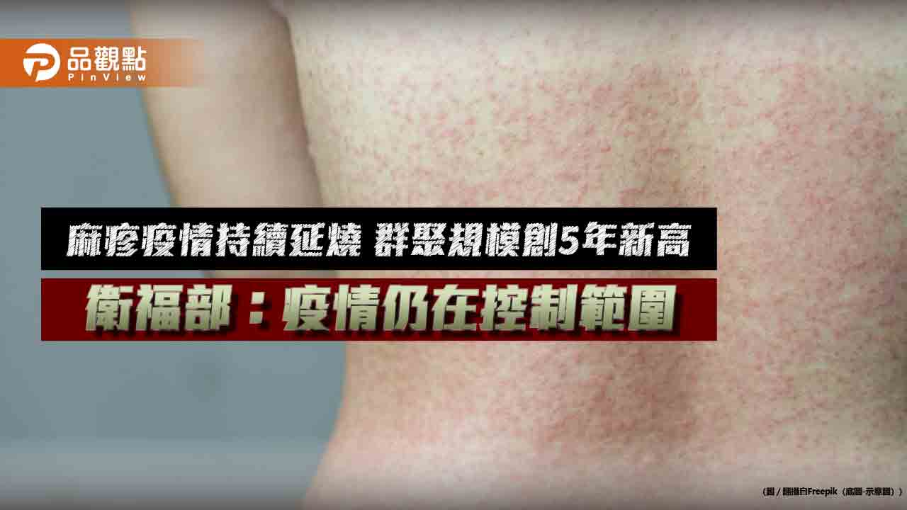 麻疹疫情持續延燒 群聚規模創5年新高 衛福部：疫情仍在控制範圍