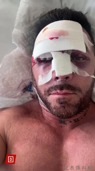 西班牙49歲網紅駕機墜毀奇蹟生還 150英尺高空墜落恐怖瞬間曝光 西班牙49歲網紅駕機墜毀奇蹟生還 150英尺高空墜落恐怖瞬間曝光