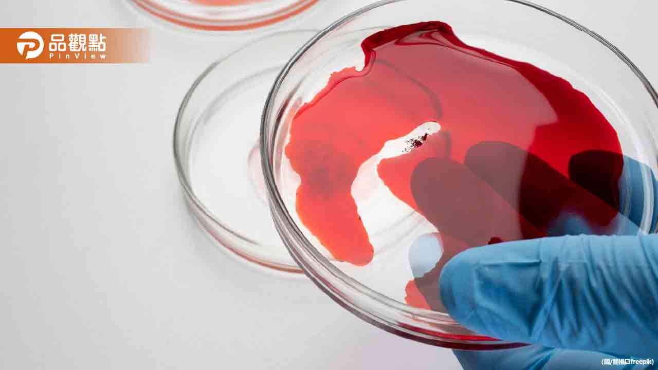 4血型好發疾病!醫:A型易胃癌、AB型注意心血管 4血型好發疾病!醫:A型易胃癌、AB型注意心血管