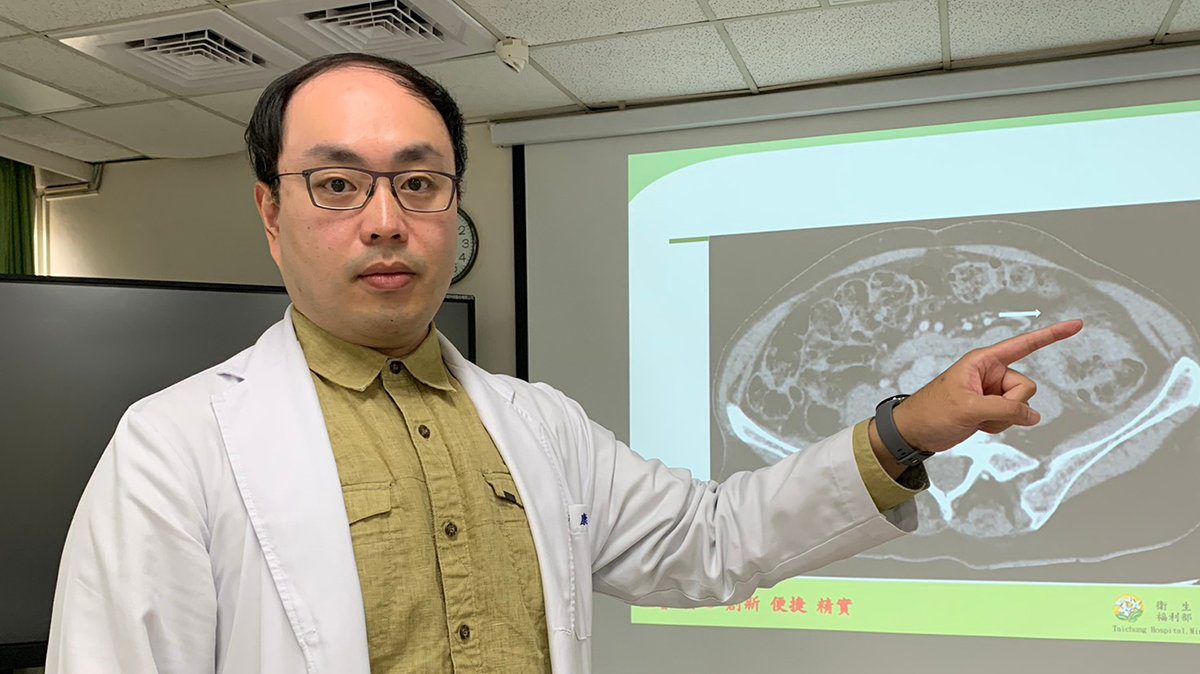 婦女節前健檢發現貧血 進一步檢查確診大腸癌 婦女節前健檢發現貧血 進一步檢查確診大腸癌