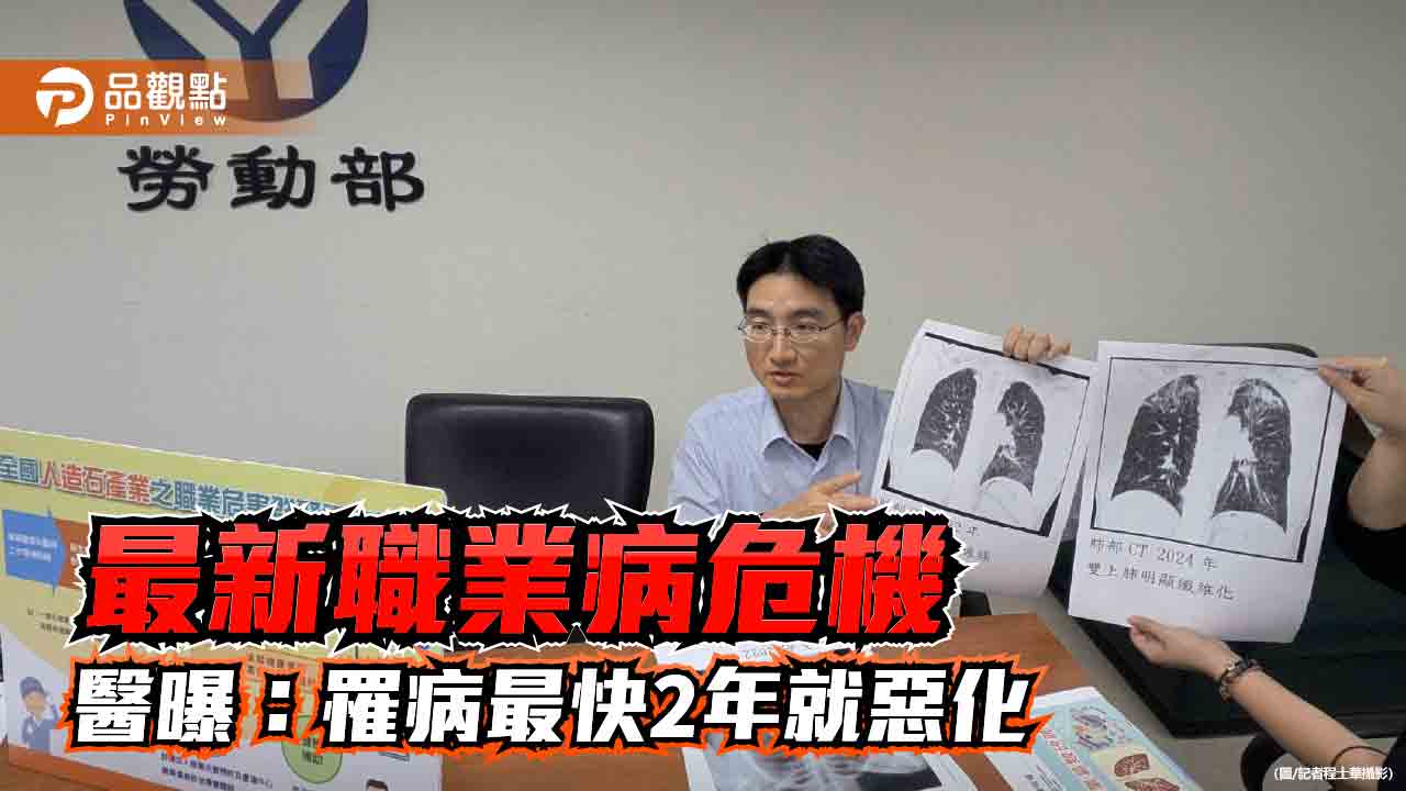 最新職業病危機 醫曝這產業罹病最快2年就惡化 最新職業病危機 醫曝這產業罹病最快2年就惡化