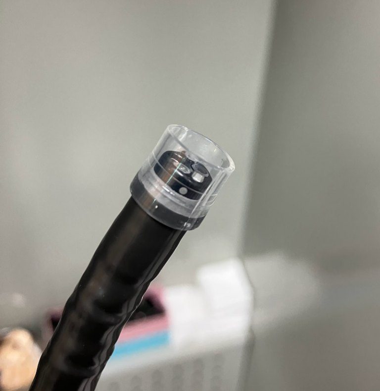 魚刺卡喉怎麼辦? 北榮蔡志奇主任:在胃鏡前端裝上透明套讓檢查更順利 魚刺卡喉怎麼辦? 北榮蔡志奇主任:在胃鏡前端裝上透明套讓檢查更順利