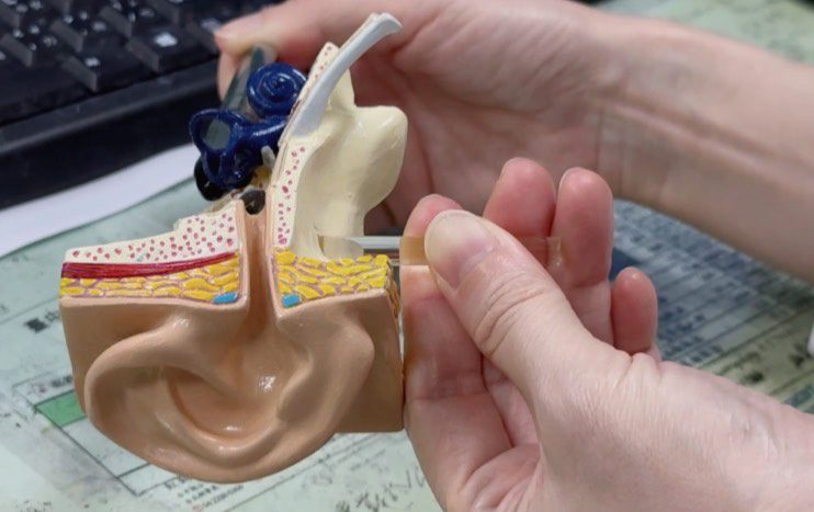 耳石脫落眩暈症 天旋地轉如搭乘雲霄飛車 耳石脫落眩暈症 天旋地轉如搭乘雲霄飛車