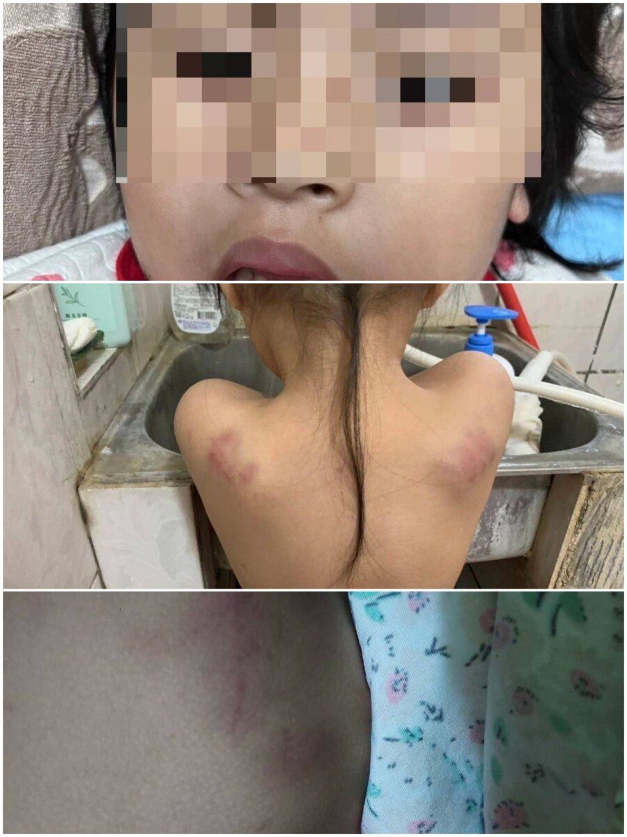 幼童疑似遭教師不當對待案 疑點重重、揭「台東縣政府教育處及關山國小五大重大失職」 幼童疑似遭教師不當對待案 疑點重重、揭「台東縣政府教育處及關山國小五大重大失職」