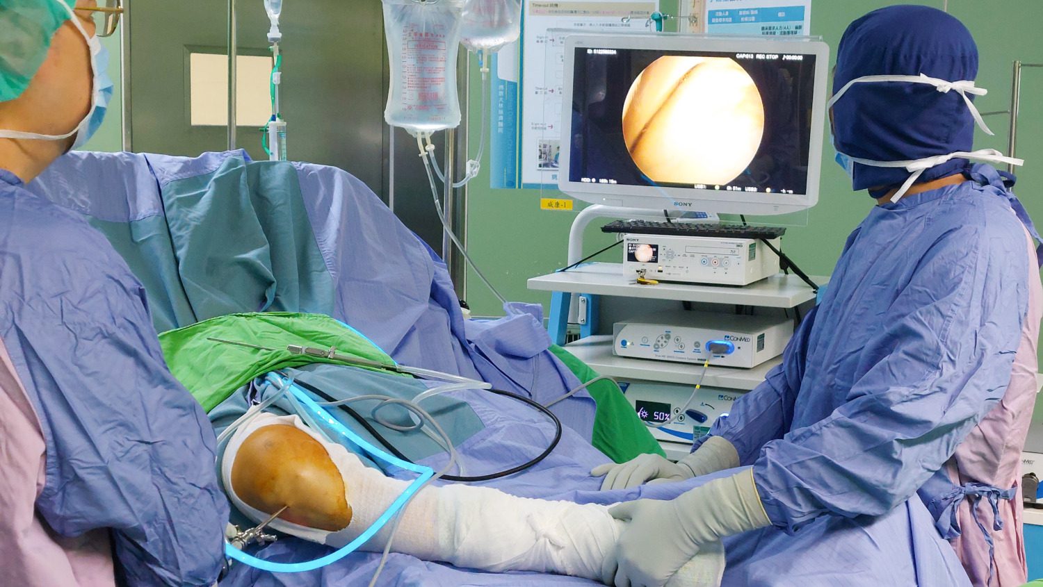 軟骨再生手術 為膝關節退化帶來新希望 軟骨再生手術 為膝關節退化帶來新希望