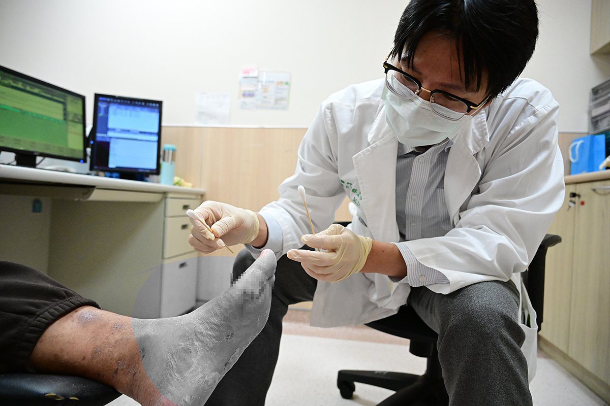 糖友國外洽公腳痛驚見血　返台急診驚曝糖尿病足危機