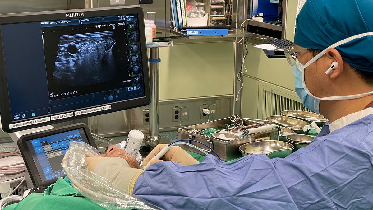 粉領族上班族頸部腫瘤近四公分　微創「消融術」除腫保器官