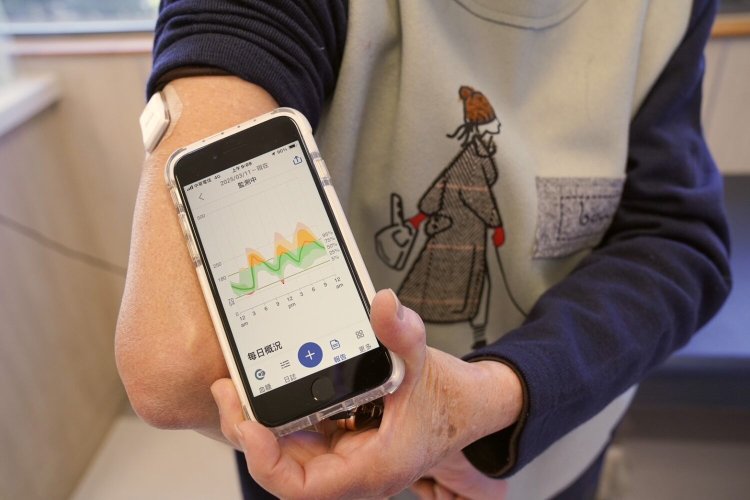 靠連續血糖監測 糖尿病患者一個月恢復正常值 靠連續血糖監測 糖尿病患者一個月恢復正常值