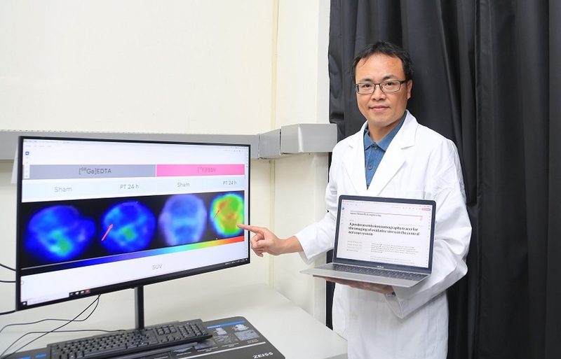 全球首創氧化壓力偵測技術 中山大學研究有望緩解阿茲海默症 全球首創氧化壓力偵測技術 中山大學研究有望緩解阿茲海默症