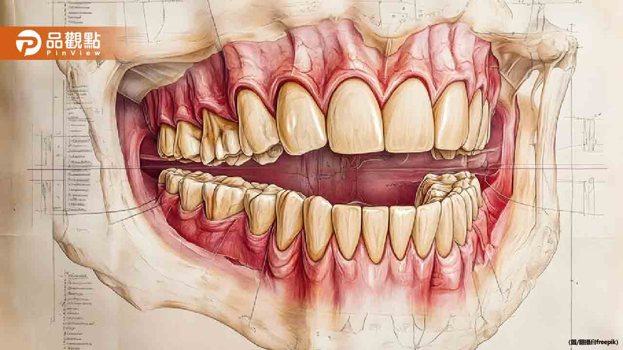 男無視牙齦長膿繼續遶境!醫嘆:拖太久只能拔掉 男無視牙齦長膿繼續遶境!醫嘆:拖太久只能拔掉