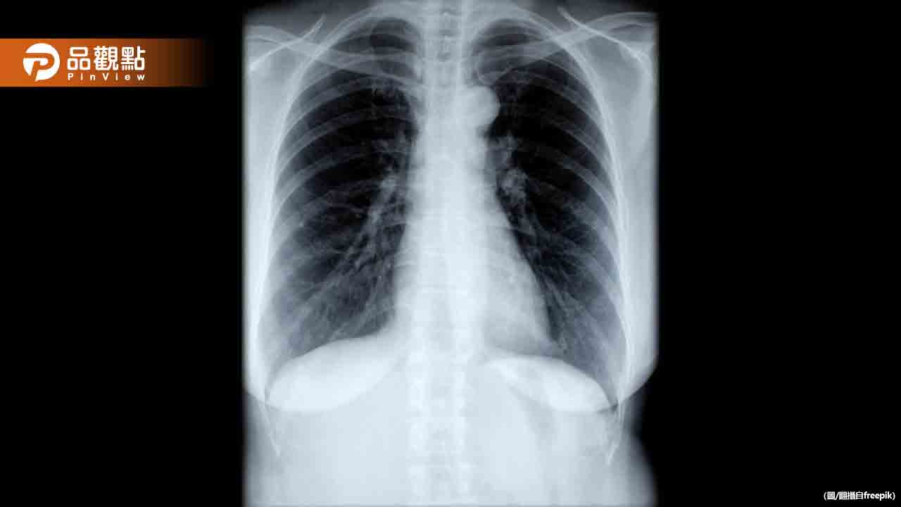 新冠單周1.9萬人就診、93人重症「雙創新高」 肺部恐現毛玻璃 新冠單周1.9萬人就診、93人重症「雙創新高」 肺部恐現毛玻璃
