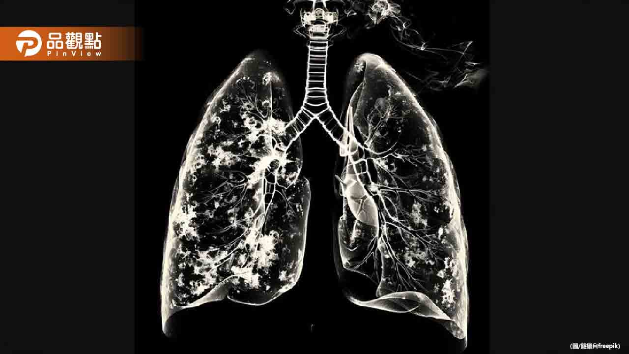 X光驚見肺部變白！40歲女喘不停 醫揭驚人真相