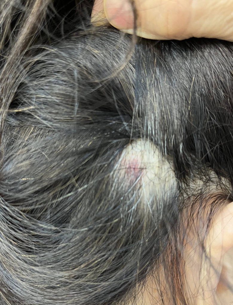 北市公園驚傳「無差別攻擊」！婦坐公園椅遭不明物「砸頭」　警要查了