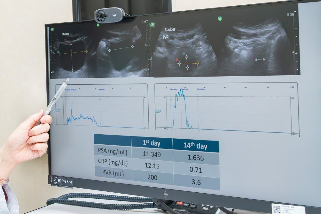 重症肌無力竟「尿」出危機!排尿藥物使用需慎評,避免誘發呼吸衰竭 重症肌無力竟「尿」出危機!排尿藥物使用需慎評,避免誘發呼吸衰竭