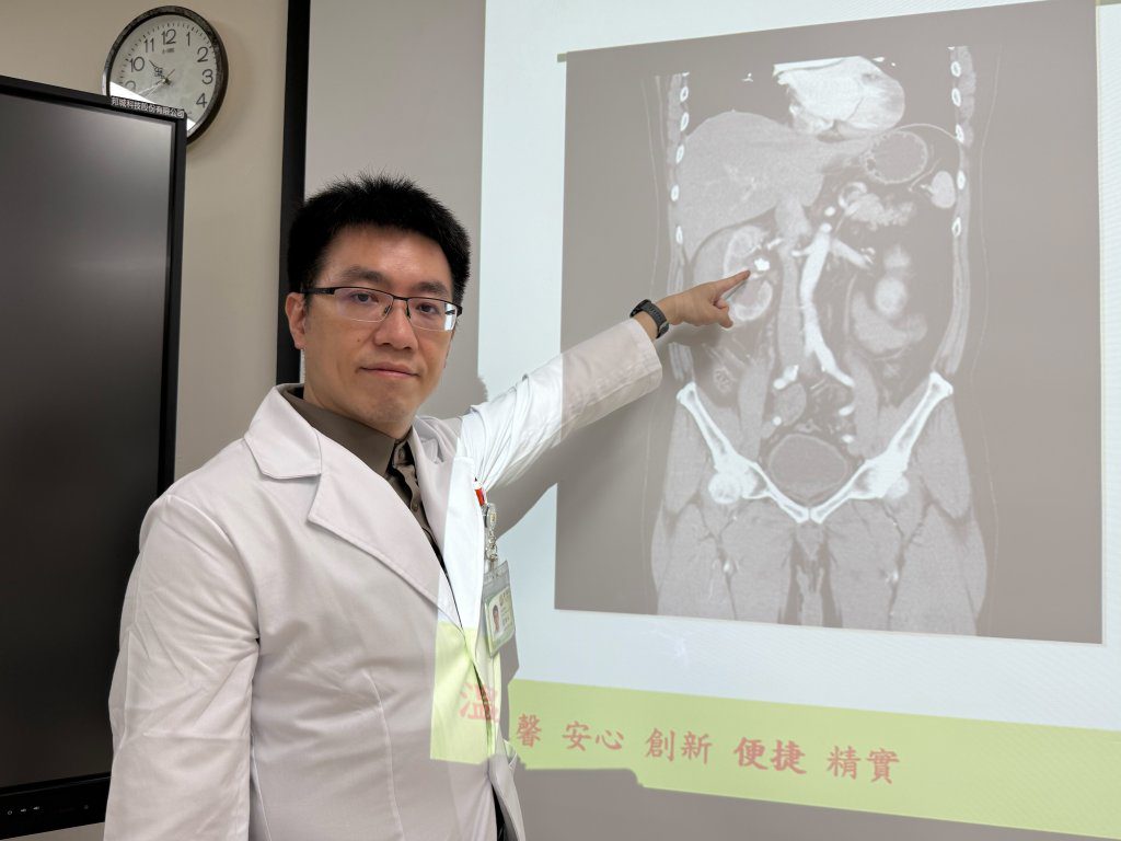 別信喝啤酒能防結石！他久坐少喝水兩年三度腎結石　