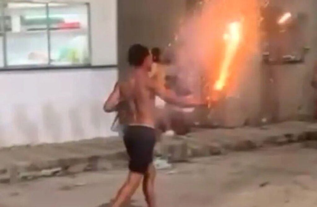 影/巴西男拿火焰劍突爆炸!右手遭炎之呼吸吞噬 血肉模糊拇指截肢 影/巴西男拿火焰劍突爆炸!右手遭炎之呼吸吞噬 血肉模糊拇指截肢