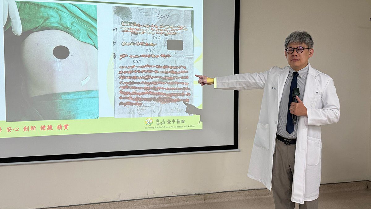 30歲美人魚乳房腫瘤險變惡性　微創手術摘除四顆腫瘤無疤救乳房