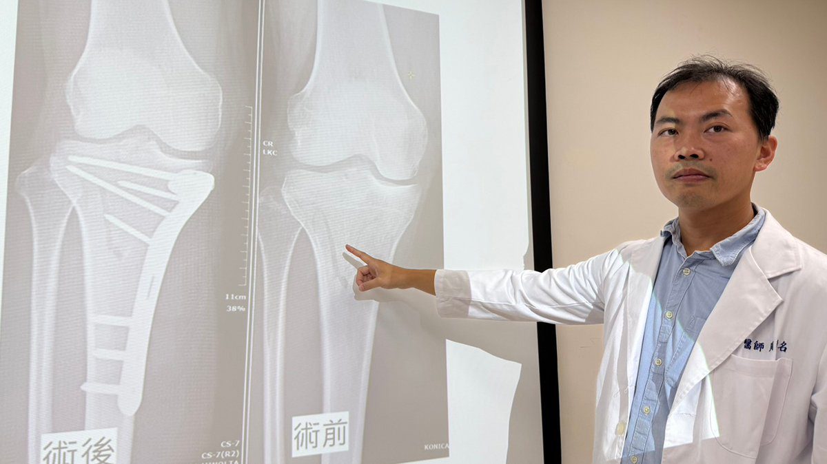 赴百貨搶購遇車禍　42歲女腿骨折靠微創手術與高壓氧迅速復原