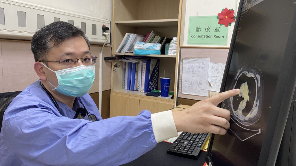 65歲女性背痛竟是主動脈剝離,醫師提醒天氣炎熱會提高風險 65歲女性背痛竟是主動脈剝離,醫師提醒天氣炎熱會提高風險