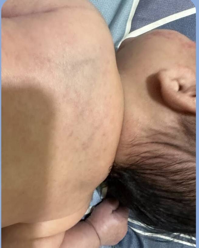 桃園八德驚傳保母不當對待幼童 家長報警並停止托育服務 桃園八德驚傳保母不當對待幼童 家長報警並停止托育服務