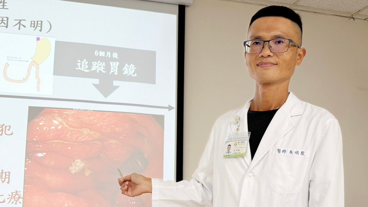 胃痛竟是癌！八旬婦人停藥致復發　醫籲耐心完成療程