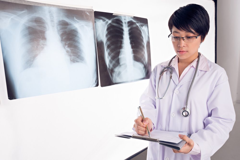 桃園鼓勵民眾及早肺癌篩檢 免費檢查還能加碼抽iPhone 桃園鼓勵民眾及早肺癌篩檢 免費檢查還能加碼抽iPhone