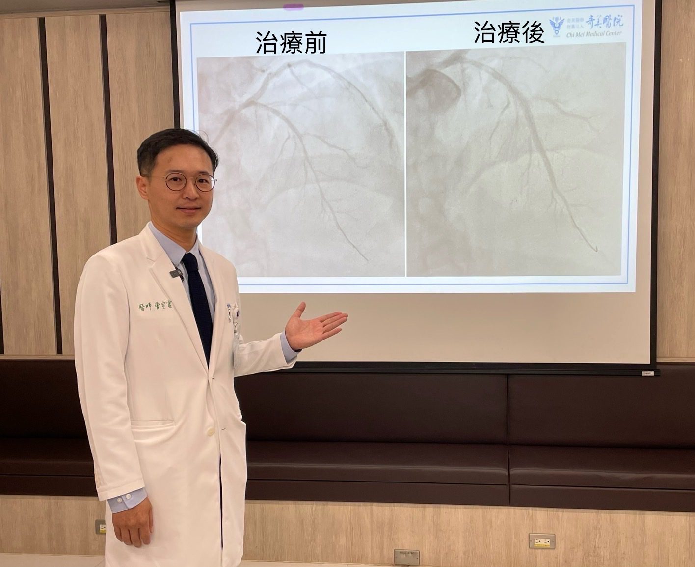 「軌道旋磨術」結合血管內超音波及震波碎石術，精準打通嚴重鈣化心血路