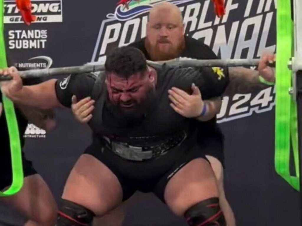 影／深蹲410公斤用力過猛　血從眼睛、頭皮噴出！選手挑戰影片瘋傳