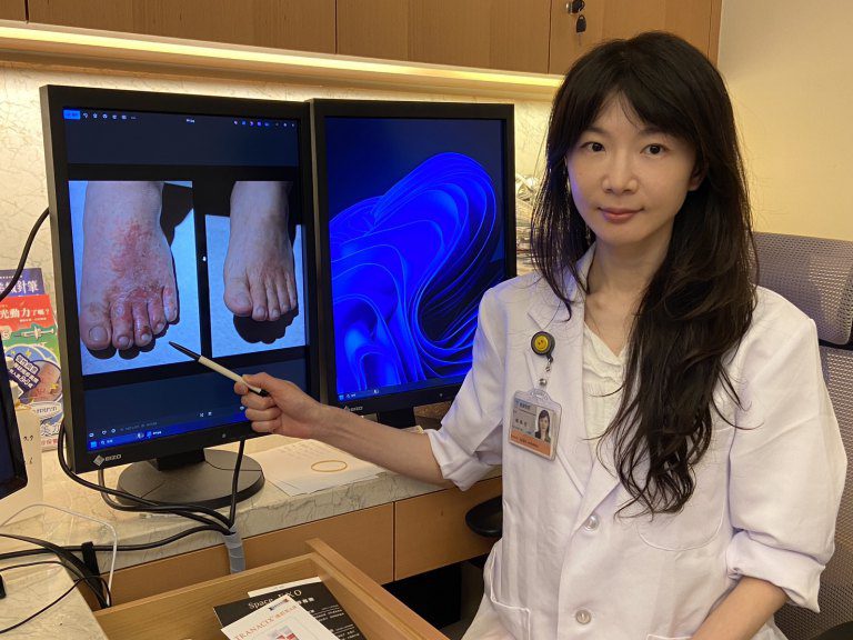 連日豪雨香港腳疫情也擴大 就醫民眾增加2成 連日豪雨香港腳疫情也擴大 就醫民眾增加2成