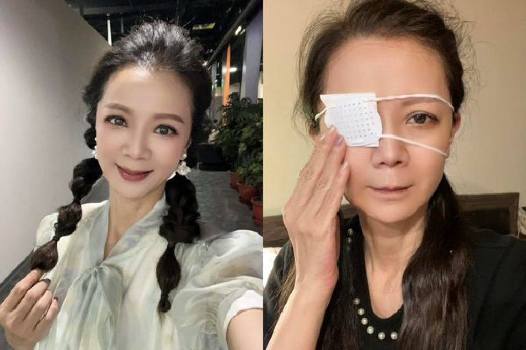 高欣欣誤點藥水險失明！急診後傷勢光　提醒瓶罐勿混放