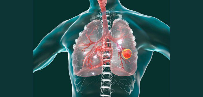 肺癌標靶治療新思維：療效與生活品質如何兼得？