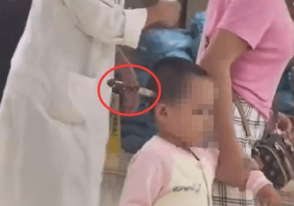 影／太嚇人！陸3歲女頭「頭插15公分水果刀」　淡定就醫動手術取出　