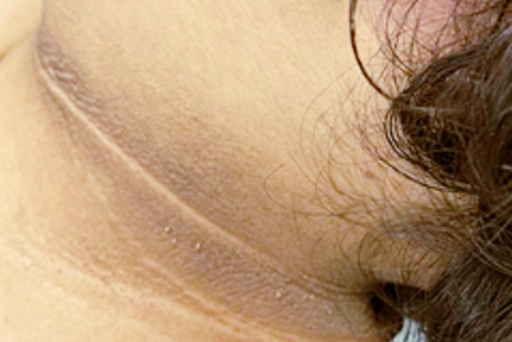 兒童肥胖不容忽視 醫提醒家長及早關注孩子生活習慣與身體變化 兒童肥胖不容忽視 醫提醒家長及早關注孩子生活習慣與身體變化