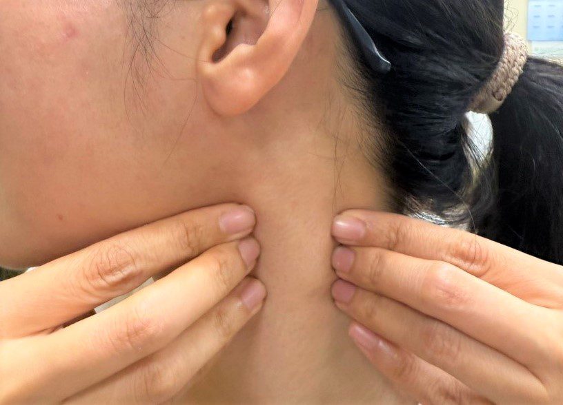 睡不好、肩頸僵硬與1文明病有關 桃園醫院:女性患者比例是男性2倍 睡不好、肩頸僵硬與1文明病有關 桃園醫院:女性患者比例是男性2倍