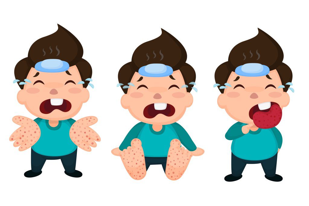 腸病毒警報！伊科病毒11型升溫 新生兒重症風險高 醫師喊「隔離三要」