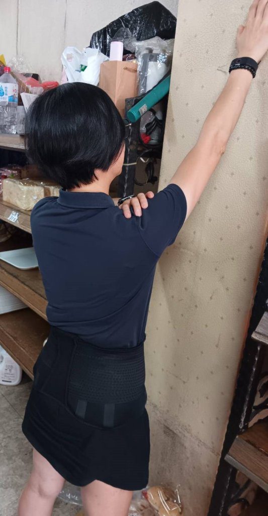 54歲婦女右肩酸痛誤為五十肩 員榮陳宏銘醫師查出脂肪瘤作祟