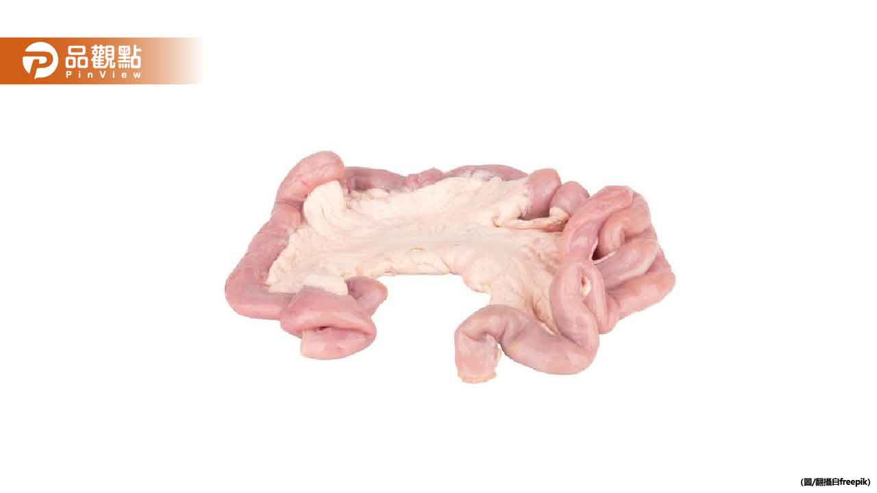 30歲養生男「一個小症狀」竟驚見大腸息肉！醫警告：恐癌變