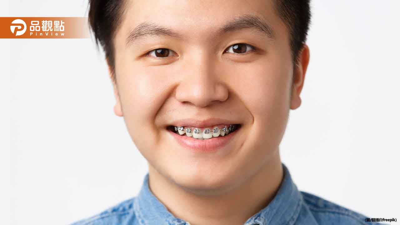 牙套戴5年「爛掉8顆牙」　女子1習慣讓醫師直搖頭