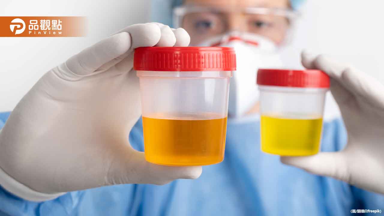 尿液如「蘋果汁」很危險！ 專家揭3大關鍵