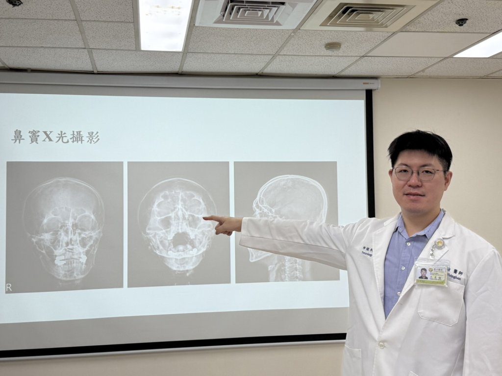 頭痛三個月吃止痛藥沒效 原來是鼻竇炎惹禍 頭痛三個月吃止痛藥沒效 原來是鼻竇炎惹禍