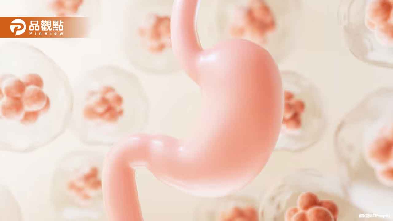 胃癌隱形殺手！9成患者體內藏這種細菌 7大族群要小心