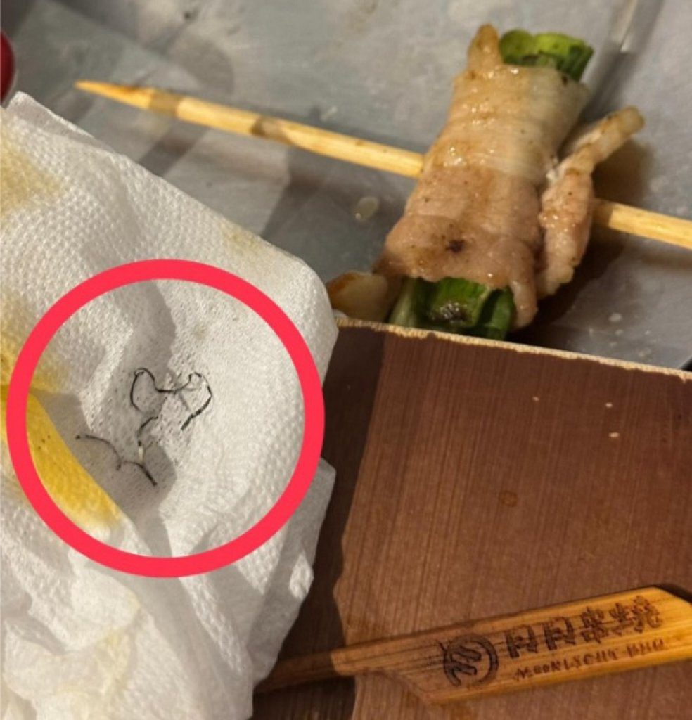 吃串燒被鐵絲割傷流血僅折143元 客傻眼 業者道歉 吃串燒被鐵絲割傷流血僅折143元 客傻眼 業者道歉