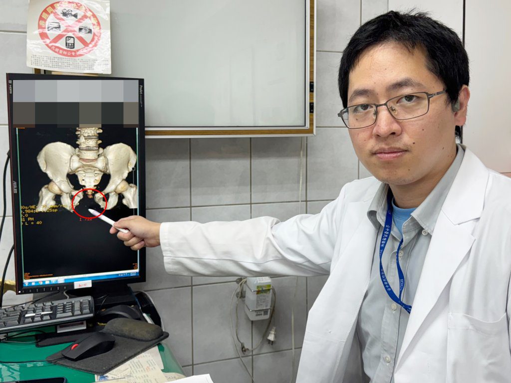 遭重擊!失血1/3、骨盆爆、腸外露 醫師鬼門關前救人