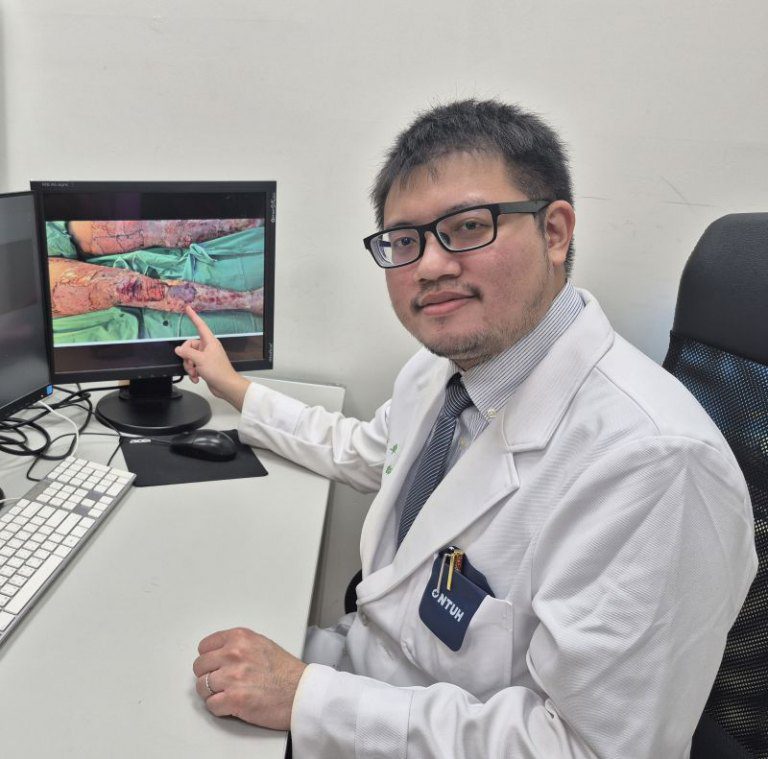 60%燒燙傷瀕危　新竹臺大分院創新療法助病人兩週內轉出加護病房