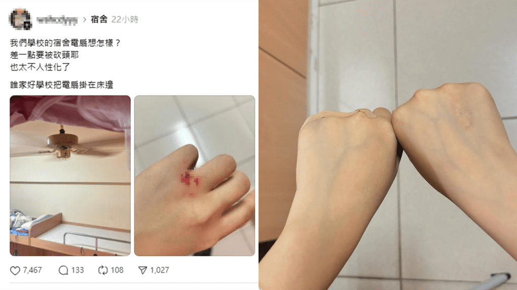 宿舍電風扇成兇器！女大生嫩手被「劃傷見血」…不只1位　校方回應了