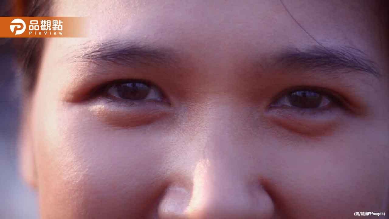 黑眼圈眼袋有救了！營養師揭密消除秘方 8招讓你重拾明亮雙眼