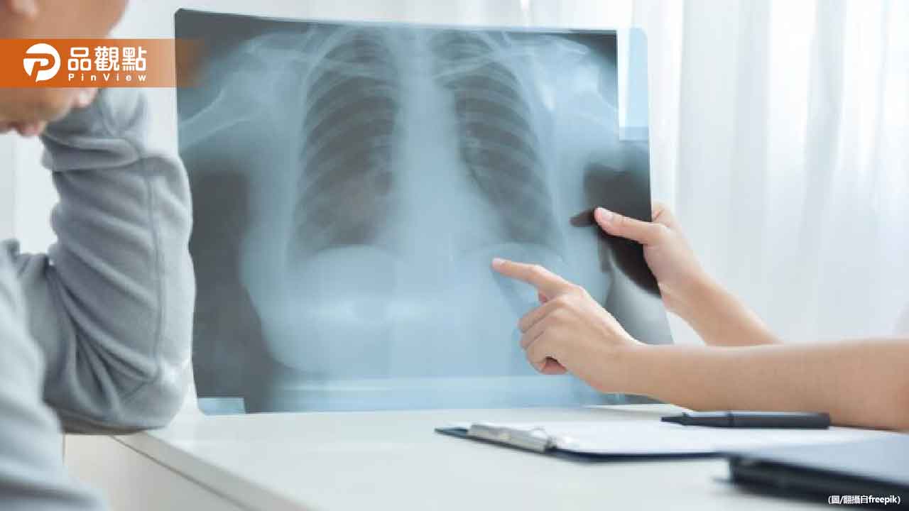 驚！60歲婦檢查驚見「肺部滿天星」 竟是「1習慣」害的
